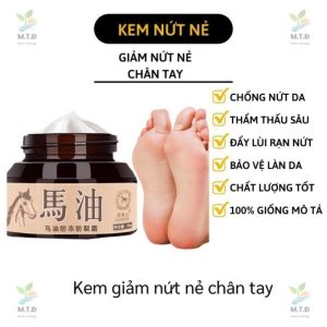 Kem Chống Nứt Chân Và Tay Hiệu Con Ngựa